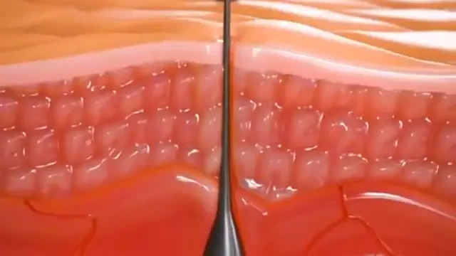Shocking Simulation Shows What Really Happens When You Pluck a Hair From Your Skin