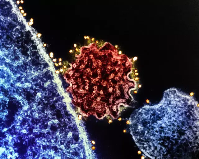 Dr Seethu Ponnu Thampi has dealt with an outbreak of the virus before.