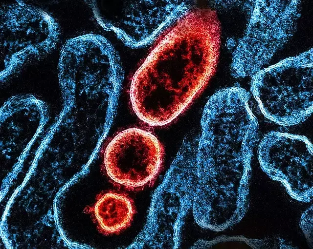 The Nipah virus can also spread from person to person.